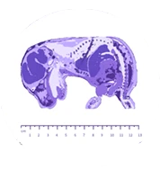 Spatially resolved transcriptomic profiling - STOmics